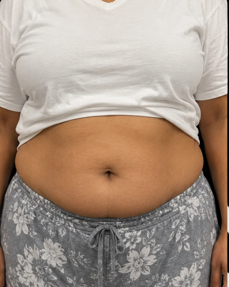 Before body sculpting, abdomen