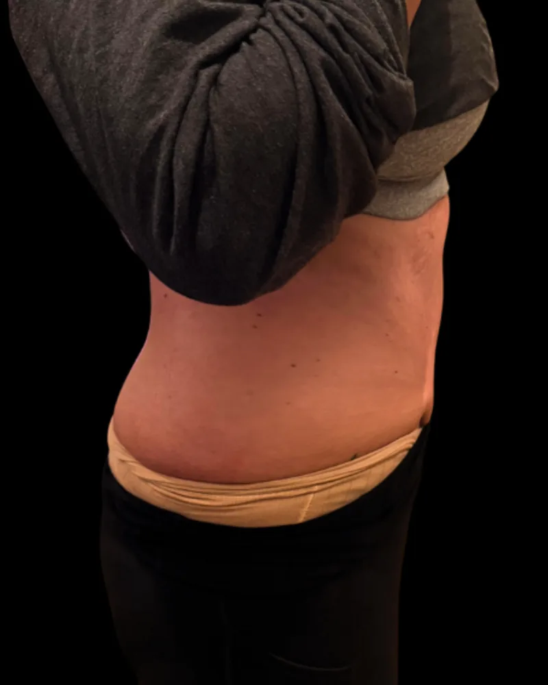 After the BAQ Method, abdomen
